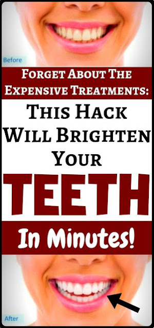 Yellow Teeth? Try This Hack! It Actually Works!