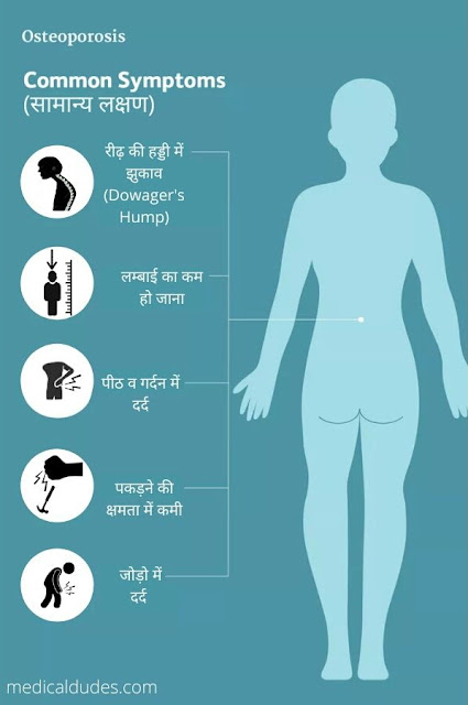 common symptoms of osteoporosis