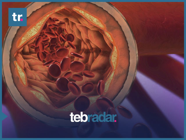 9 تجارب تساعد على خفض نسبة الكولسترول بسرعة في أسبوع