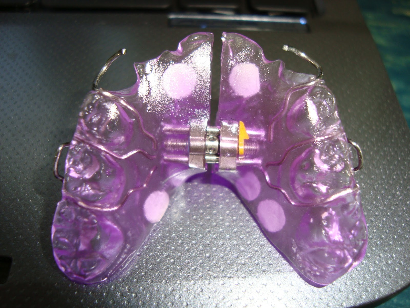 Catena Di Potenza Elastica Dentale Da 15 Piedi Per Apparecchi - Foto 3