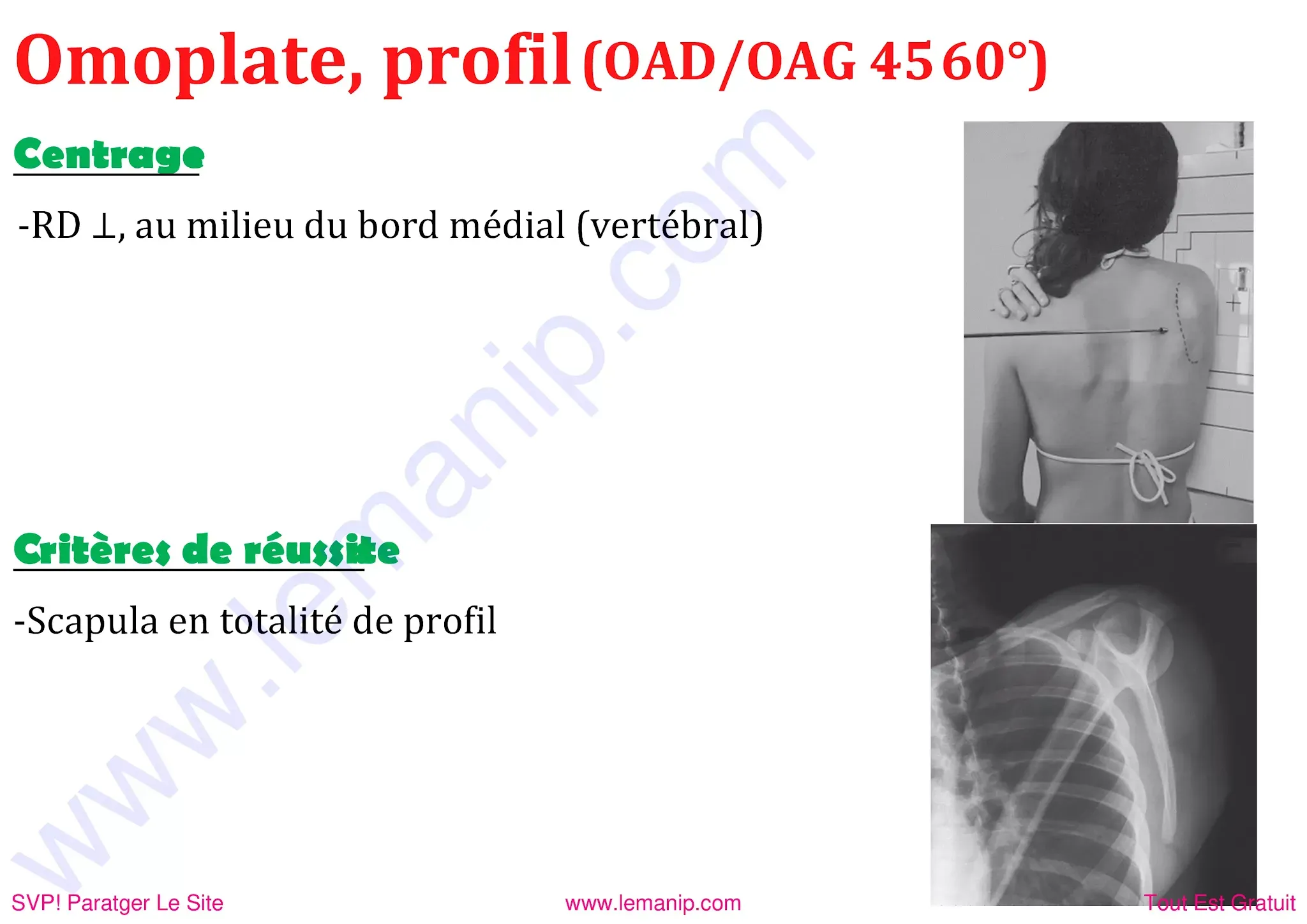 omoplate de profil oad oag