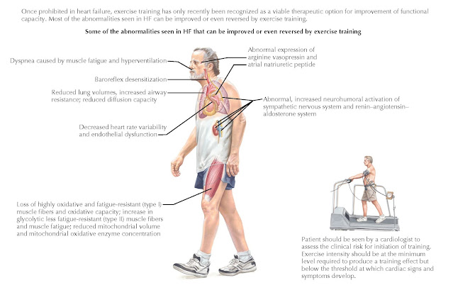 Exercise Training in Heart Failure (HF).