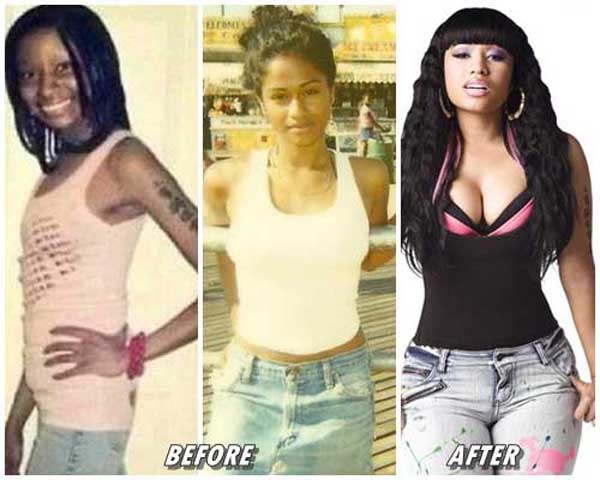 See Pictures Of Nicki Minaj Before She Did Plastic Surgery