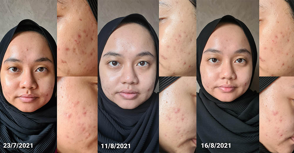 Review The Ordinary Alpha Arbutin 2 + HA Serum — miracikcit