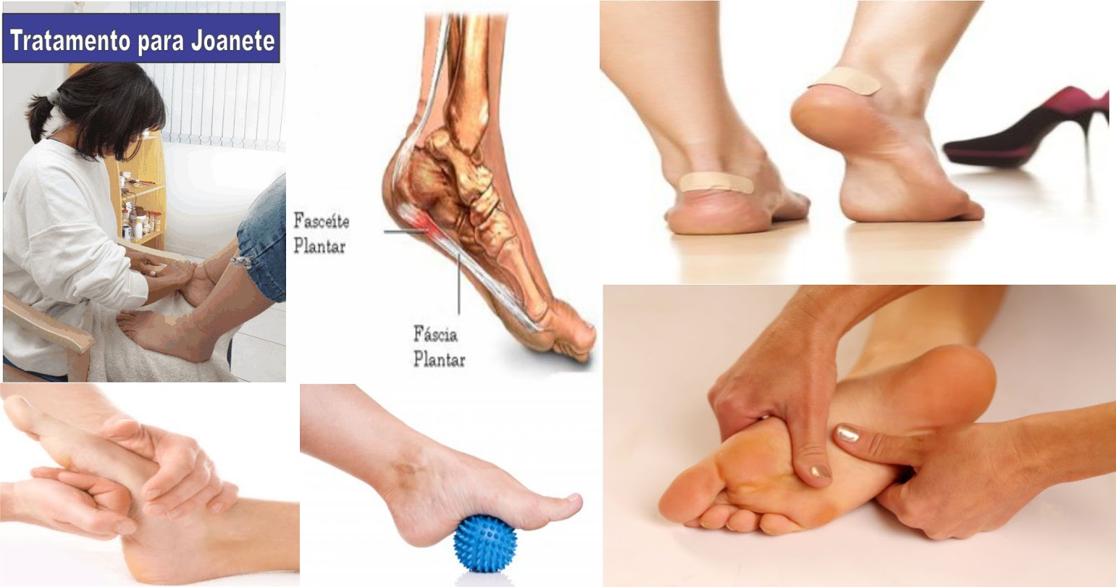 Centro Complementar Massagem para fascite plantar