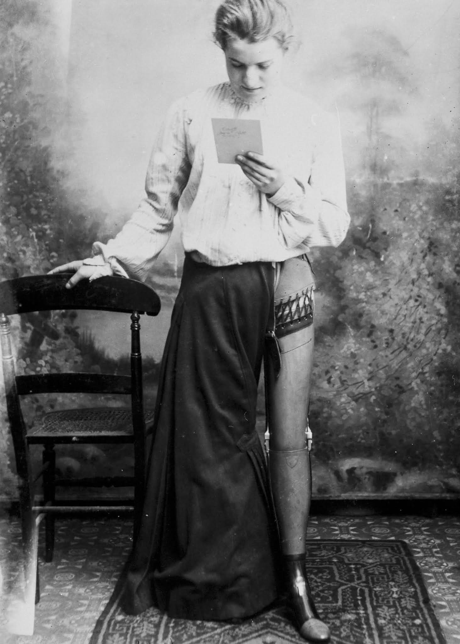 The extraordinary early prostheses made by James Gillingham  1900 - 58