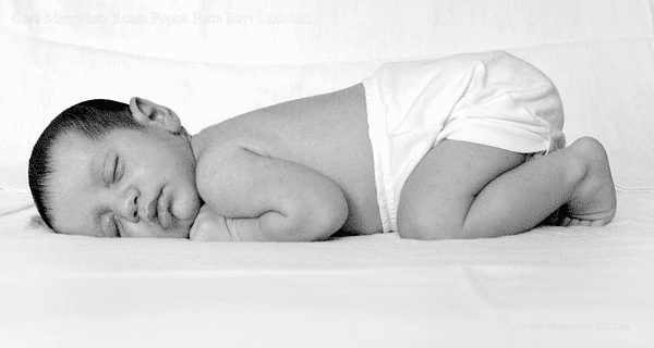 Ruam Popok pada Bayi