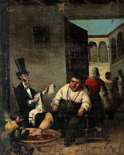 Кровопускание из ноги.  Неизвестный художник по рисунку Оноре Домье. XIX век Wellcome Collection