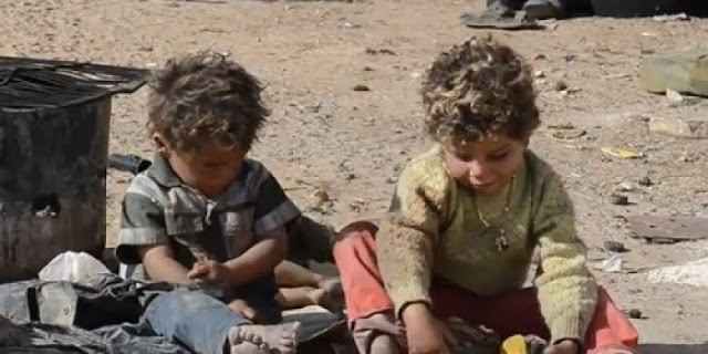 Anak-Anak Terluka di Aleppo Kelihatan Penglihatan karena Minimnya Fasilitas Kesehatan Anak-Anak Terluka di Aleppo Kelihatan Penglihatan karena Minimnya Fasilitas Kesehatan