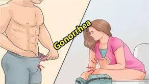 CAIRAN BENING SEPERTI KEPUTIHAN VAGINA KELUAR NANAH TAPI SEDIKIT CAIRAN BENING SEPERTI KEPUTIHAN VAGINA KELUAR NANAH TAPI SEDIKIT