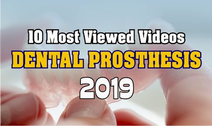 10 Most Viewed DENTAL PROSTHESIS Videos in 2019