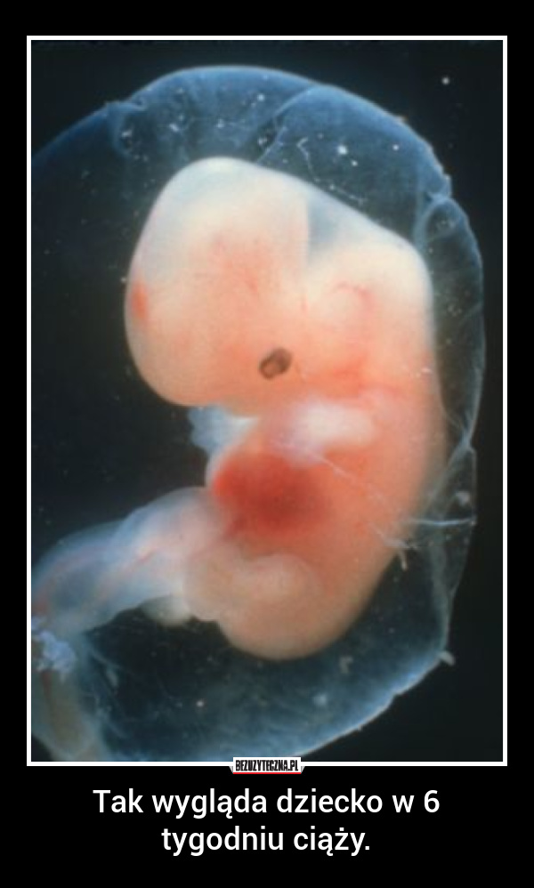 Что будет через 5 недель. Эмбрион на 6 неделе беременности. Эмбрион 5-6 недели беременности. 5 6 Недель беременности фото эмбриона. Эмбрион 5,5 5 неделя берем.