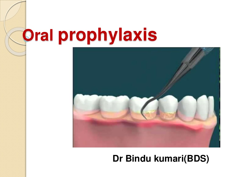 Teeth Diseases and Cure 2022 What Is Prophylaxis?
