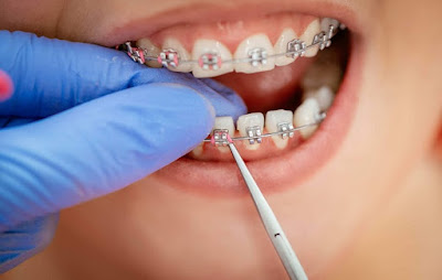 Orthodontist Melbourne