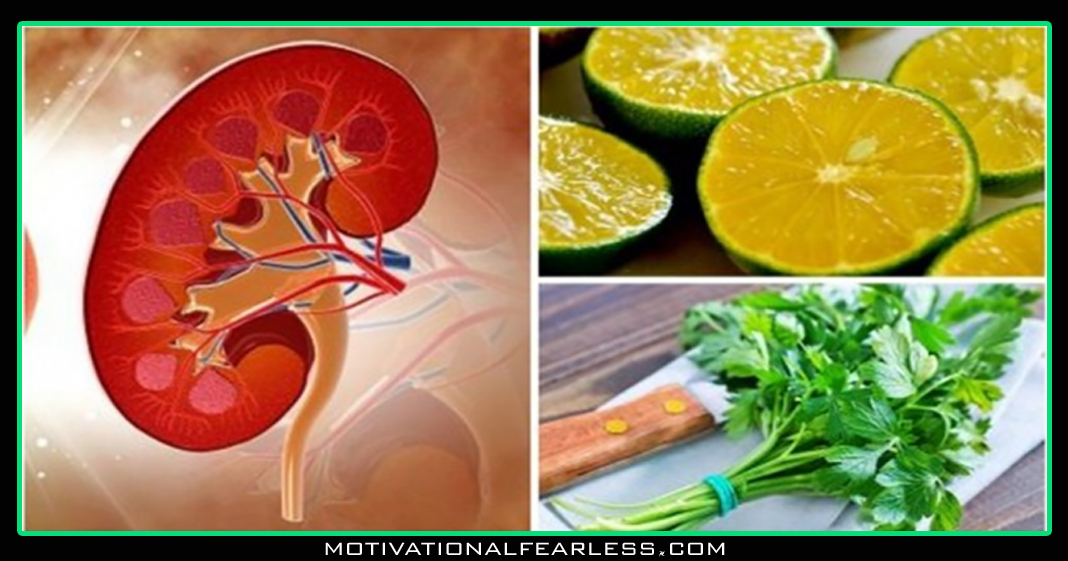 Physicians' favorite natural lemon recipe for eliminating kidney stones