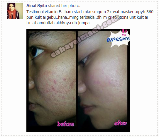 Testimoni vitamin E Shaklee untuk kulit