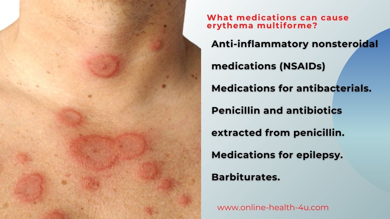 define-of-erythema-multiforme-and-symptoms-causes-erythema-multiforme
