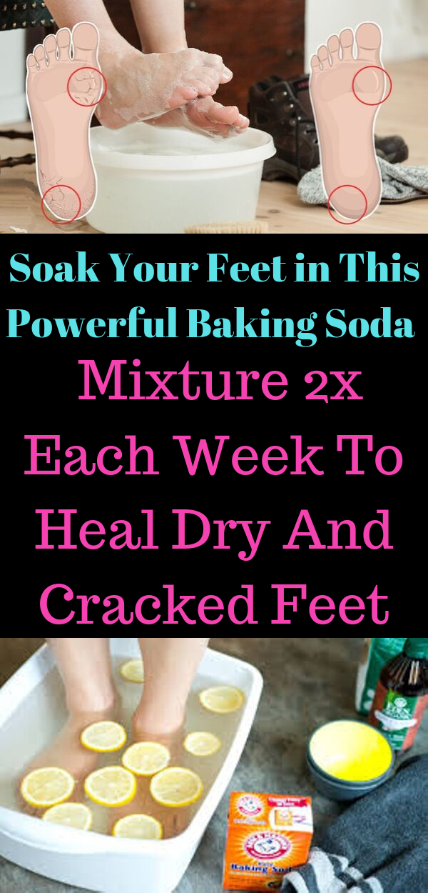 Soak Your Feet in This Powerful Baking Soda Mixture 2x Each Week To