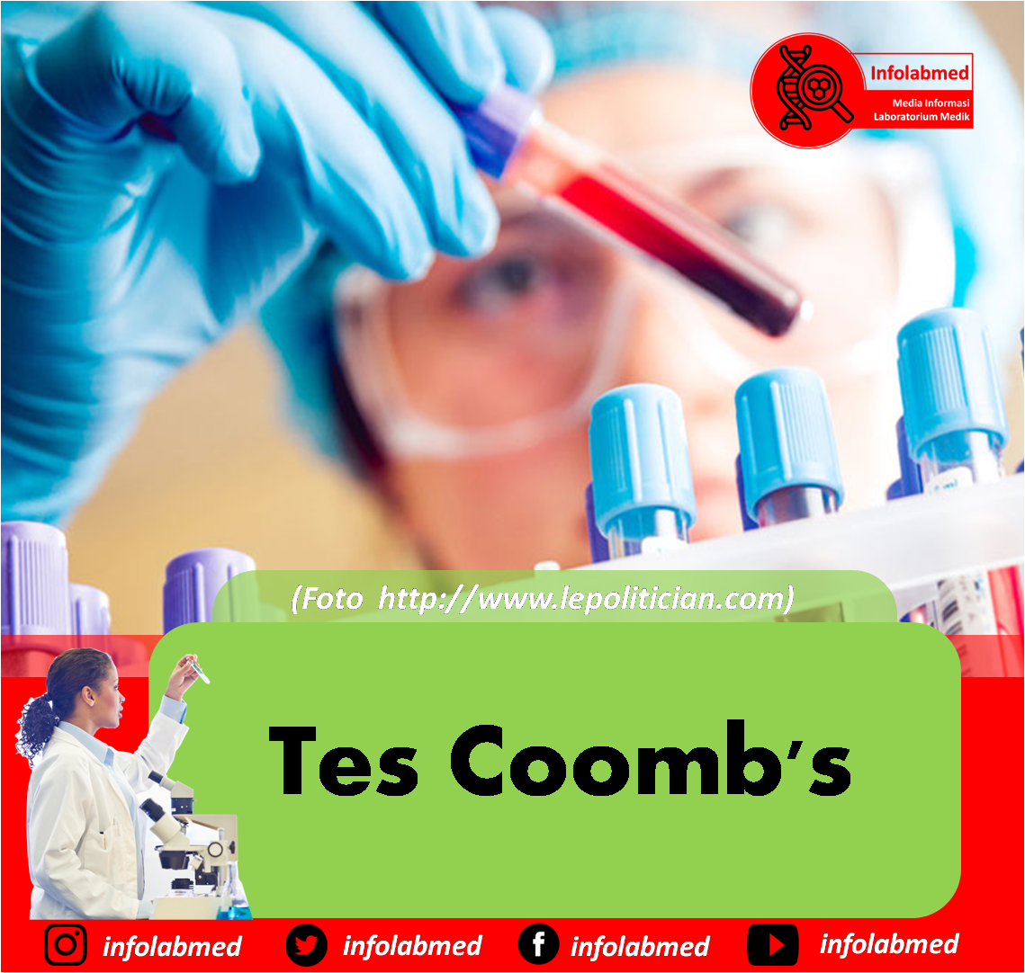 Tes Coomb's [Persiapan Pasien, Prinsip, Alat dan Bahan, Cara Kerja