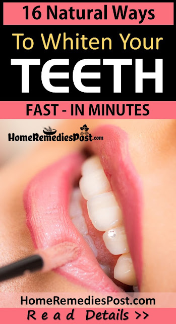 16 Natural Ways To Whiten Your Teeth Fast At Home Today Teeth Whitening, Yellow Teeth, How To Get Rid Of Yellow Teeth, Home Remedies For Teeth Whitening, Home Remedies For Yellow Teeth, Fast Teeth Whitening, Teeth Whitening Treatment, Teeth Whitening Home Remedies, How To Treat Yellow Teeth, How To Cure Yellow Teeth, Teeth Whitening Remedies, Remedies For Teeth Whitening, Treatment For Teeth Whitening, Best Teeth Whitening Treatment, How To Get Rid Of Yellow Teeth Fast, Yellowness in Teeth