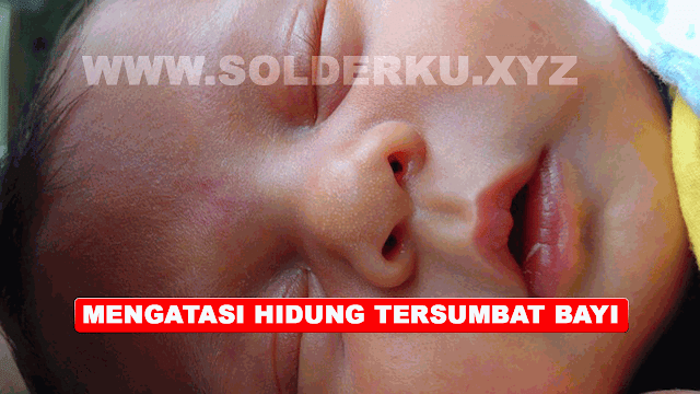 5 PENYEBAB HIDUNG TERSUMBAT PADA BAYI 