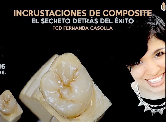 INCRUSTACIONES de Composite: El secreto detrás del éxito - TCD Fernanda Casolla