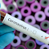First human trial of potential coronavirus vaccine started in the U.S.