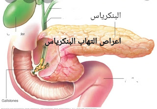 ماذا يأكل مريض التهاب البنكرياس