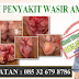 Cara Ini Dinilai Dapat Menyembuhkan Ambeien Tanpa Operasi thumbnail