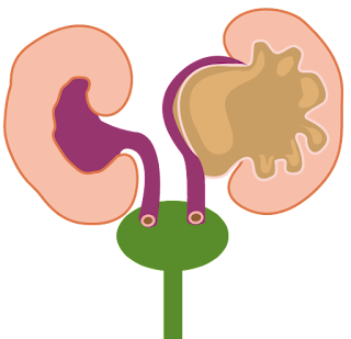 Comienza el curso de Continuum "Patología renal del recién nacido y del equilibrio hídrico 2021"