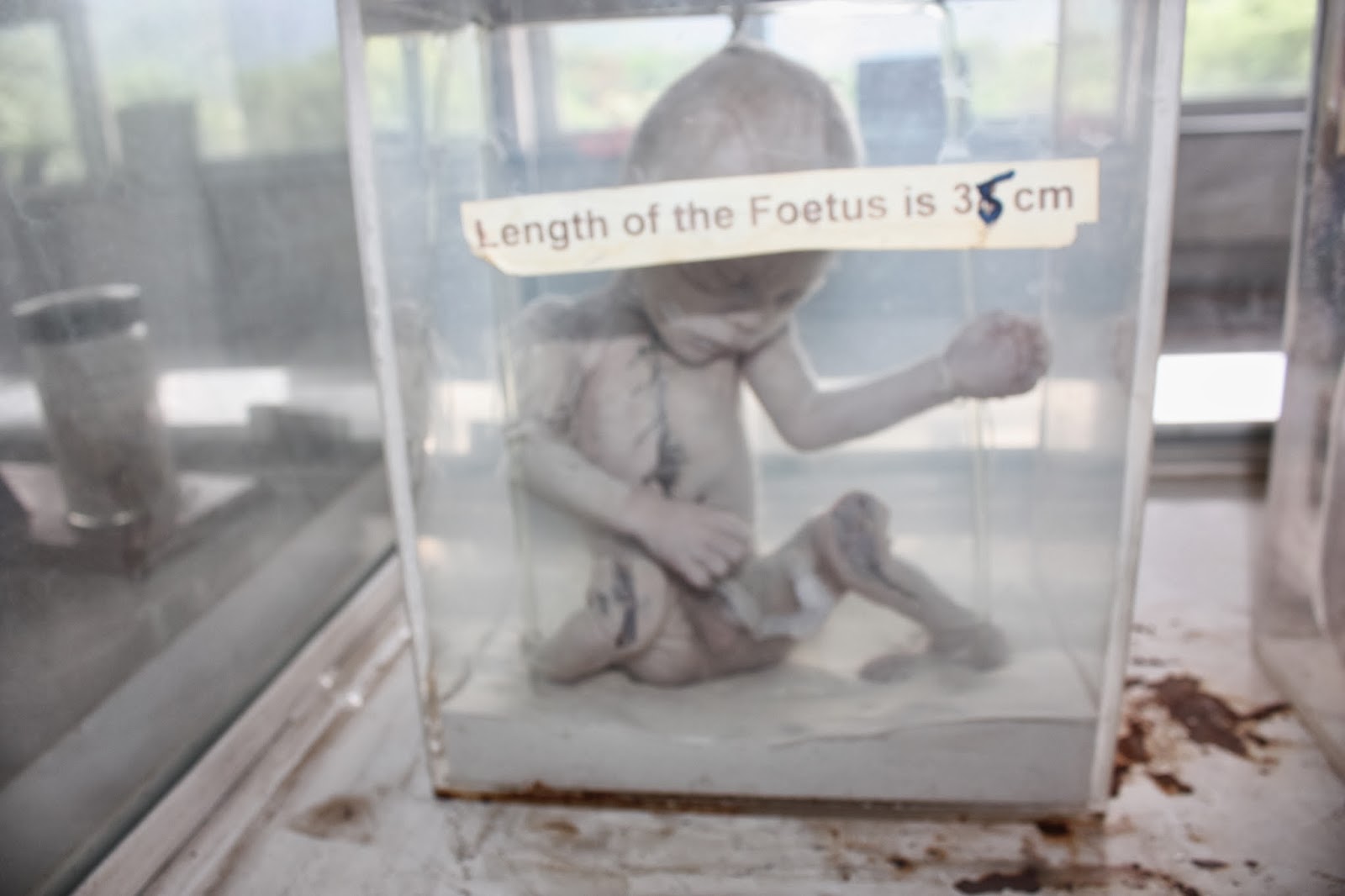 Forensic Medicine and Toxicology: 2014