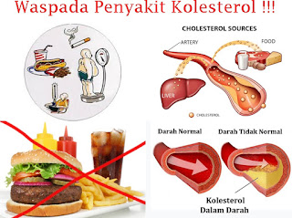 Cara Menjaga Agar Kolesterol Tetap Stabil