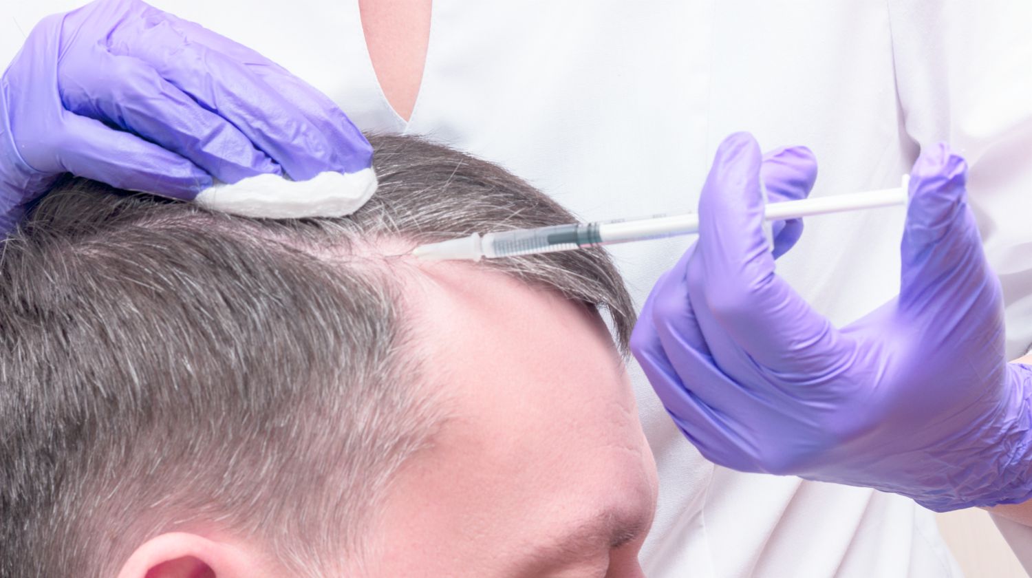 Hair Stylist Platelet Rich Plasma Prp Frequently Asked