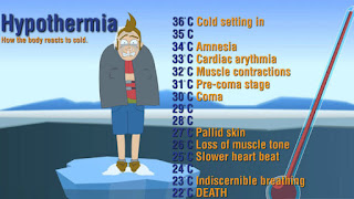 hipotermia-www.healthnote25.com