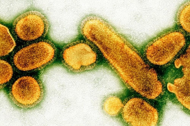 Вот так выглядел вирус испанского гриппа, в 1918 году унесшего жизни от 50 до 100 млн человек (по разным оценкам)