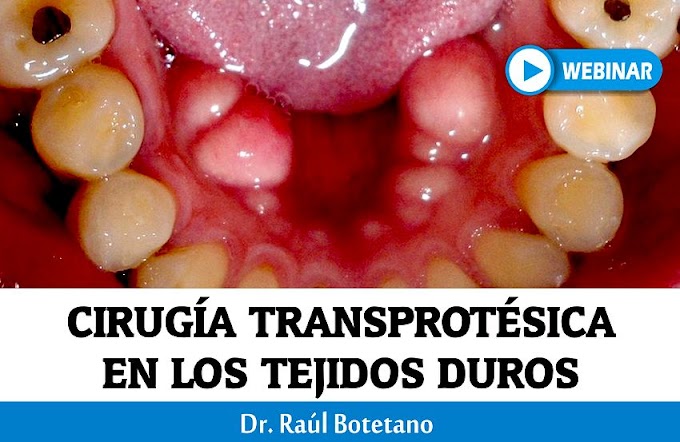 CIRUGÍA TRANSPROTÉSICA en los tejidos duros - Dr. Raúl Botetano