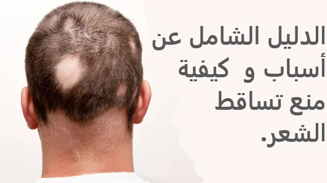 تساقط الشعر,علاج تساقط الشعر,منع تساقط الشعر,لمنع تساقط الشعر,علاج تساقط الشعر نهائيا,لتساقط الشعر,افضل علاج لتساقط الشعر,حل تساقط الشعر,دور التغذية السليمة في منع تساقط الشعر,أسباب تساقط الشعر,اسباب تساقط الشعر,كيفية منع تساقط الشعر,طرق علاج تساقط الشعر,تساقط الشعر عند البنات,تكثيف الشعر,كيفية منع تساقط الشعر للبنات,كيفية منع تساقط الشعر للرجال,كيفية منع تساقط الشعر طبيعيا,كيفية منع تساقط الشعر وتكثيفه,كيفية منع تساقط الشعر بعد الولادة,علاج الثعلبة,الثعلبة,مرض الثعلبة,داء الثعلبة,الثعلبة عند الاطفال,اسباب الثعلبة,ثعلبة,الثعلبة وعلاجها,علاج الثعلبة بالثوم,علاج الثعلبه,ثعلبة الشعر,علاج الثعلبة للاطفال,علاج الثعلبة في الشعر,علاج الثعلبة عند الاطفال,الثعلبه,تعريف الثعلبة,مسببات الثعلبة,هل الثعلبة معدية,الثعلبة البقعية,طرق علاج الثعلبة,ما هو مرض الثعلبة,علاج مرض الثعلبة,علاج داء الثعلبة,الثعلبة والنساء,التخلص من الثعلبة,ما هو علاج الثعلبة,علاج الثعلبة مجرب,تساقط الشعر,أسباب تساقط الشعر,علاج تساقط الشعر,اسباب تساقط الشعر,أسباب تساقط الشعر وعلاجه,أسباب تساقط الشعر عند البنات,أسباب تساقط الشعر عند النساء,ما أسباب تساقط الشعر عند النساء,اسباب تساقط الشعر وعلاجه,أسباب تساقط الشعر عند النساء وعلاجه,اسباب تساقط الشعر عند الشباب,اسباب تساقط الشعر عند البنات,طرق علاج تساقط الشعر,الشعر,علاج تساقط الشعر للرجال,اسباب سقوط الشعر,علاج تساقط الشعر بعد الولادة,افضل علاج لتساقط الشعر,أسباب تساقط,حل تساقط الشعر الدليل الشامل عن أسباب و كيفية منع تساقط الشعر.