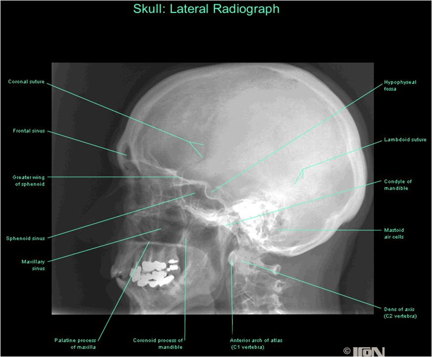Skull X Ray Positioning Chart