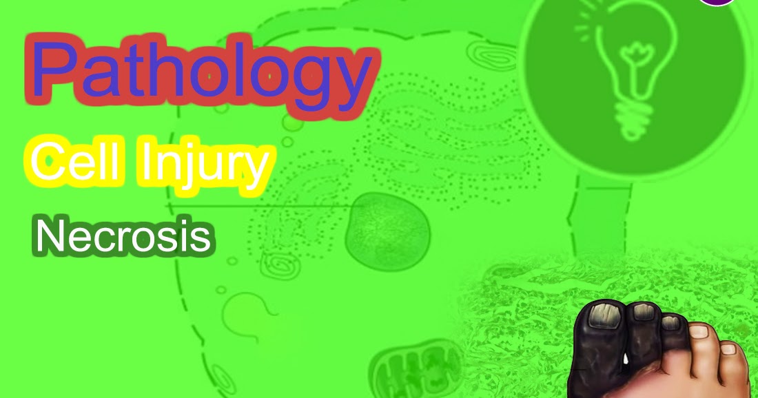 Necrosis ,Definition, Causes, Types, Mechanisms and morphology