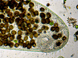 Il Microscopio