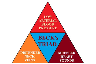 becks triad becks triad