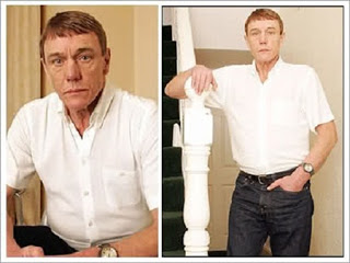 Woow Kelainan dan beberapa fakta manusia unik di dunia Woow Kelainan dan beberapa fakta manusia unik di dunia