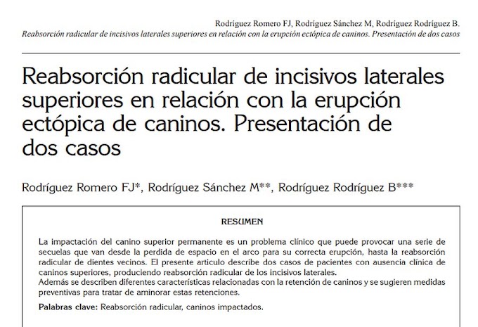 PDF: Reabsorción radicular de incisivos laterales superiores en relación con la erupción ectópica de caninos. Presentación de dos casos