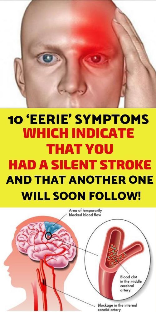 10 ‘Eerie’ Symptoms Which Indicate That You Had A Silent Stroke And