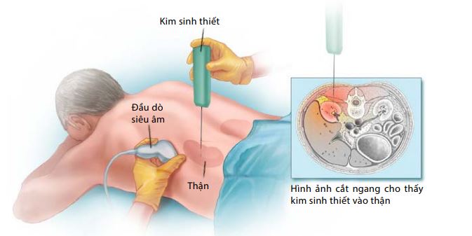 Chế độ ăn uống bệnh suy thận được xét nghiệm covid-19 tại Hàn 060621%2BM%25C3%25B4%2Bt%25E1%25BA%25A3%2Bvi%25E1%25BB%2587c%2Bsinh%2Bthi%25E1%25BA%25BFt%2Bth%25E1%25BA%25ADn-min