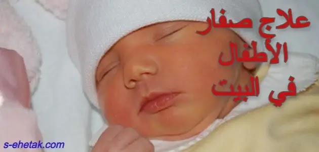 علاج صفار الأطفال في البيت علاج صفار الأطفال في البيت