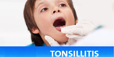 Hilangkan Tonsil Dengan 6 Cara