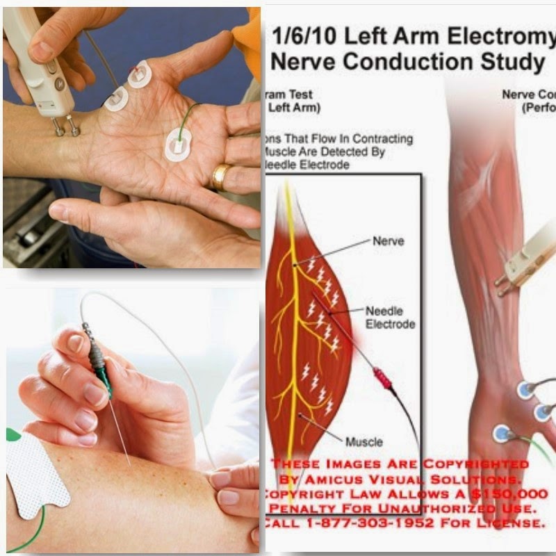 MS Brown (A Multiple Sclerosis Journey) "You're Going to Stick that