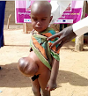 Little boy with unidentified umbilical problem spotted in Damaturu