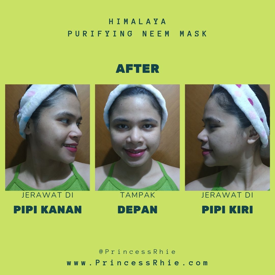 Review Himalaya Purifying Neem Mask Masker Jerawat Terbaik